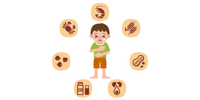アトピー性皮膚炎の新薬開発へ かゆみの根本的な治療に希望の光!