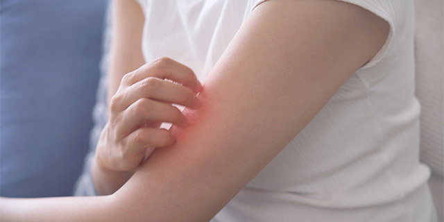 かいたらあとが残ってしまう・・・そのかゆい傷あとケアについて医師が解説