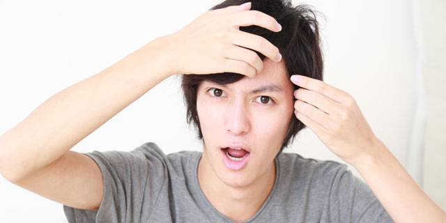 自分やパートナーの抜け毛が気になり始めたら…1分でできるAGAチェック!
