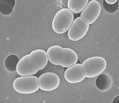 乳酸菌ラクトコッカス20-92の電子顕微鏡写真