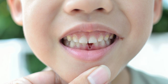 《超悶絶級》死ぬかと思った歯にまつわるエピソード5選
