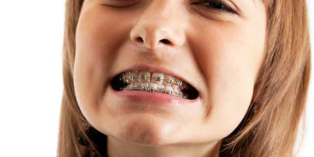 《超悶絶級》死ぬかと思った歯にまつわるエピソード5選