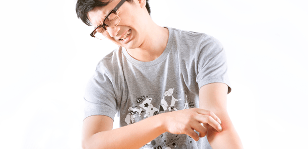 2月17日~2月23日は「アレルギー週間」。大人になってからも要注意なアレルギーはこの2つ!