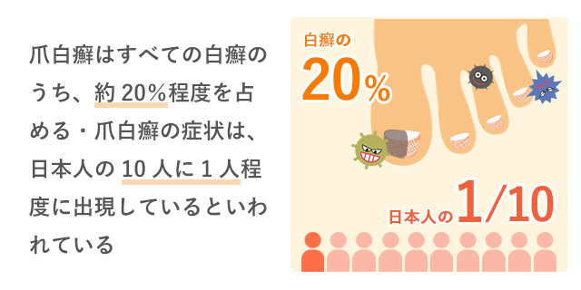 爪白癬の説明