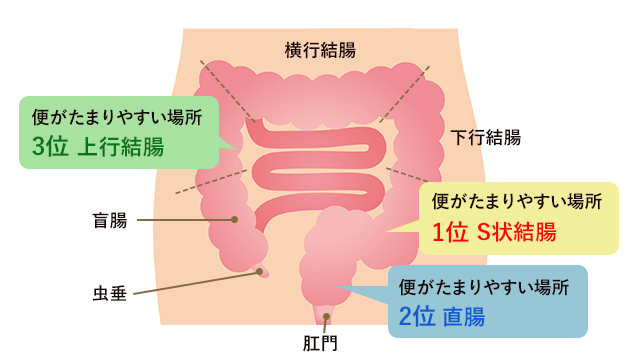 便秘が起きている場所